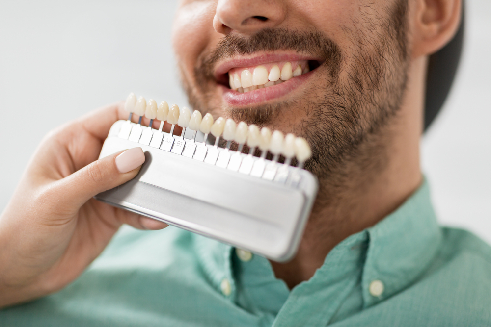 A man is assessing the color of his teeth for porcelain veneers.