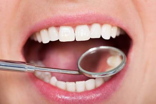 Which Dental Issues Can Be Hereditary?